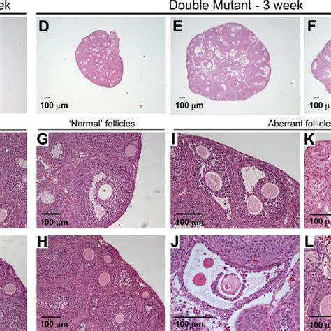 Double Mutant Ovary Luteinized Like Cells Express 3 ␤ Hsd A Control