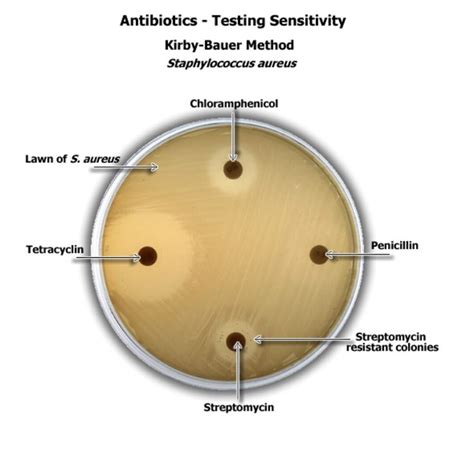 Kirby Baeur Disc Diffusion Technique Of Antibiotic Testing