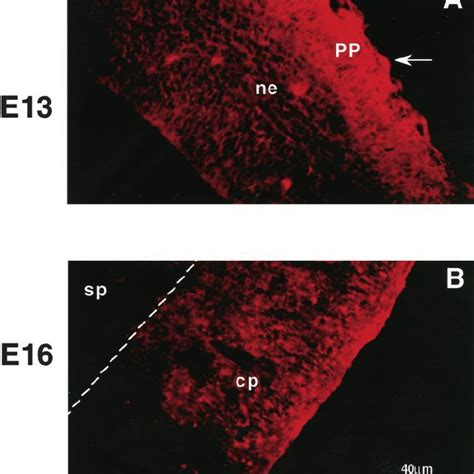 Glutamate Immunoreactivity In The Embryonic Murine Cortex Photomicro