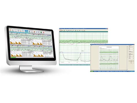 Edan F Fetal Monitor Sains Medika Sdn Bhd