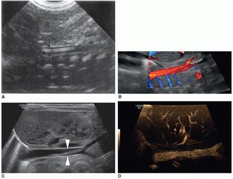 The Pediatric Abdomen Radiology Key