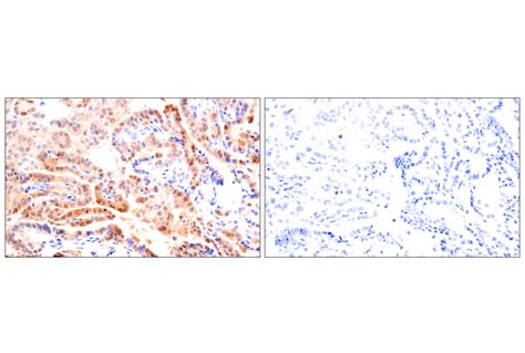 ACBP DBI E6K8G XP Rabbit MAb Cell Signaling Technology