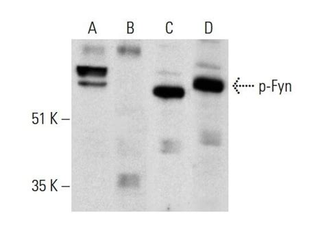 p Fyn抗体 D 1 SCBT Santa Cruz Biotechnology