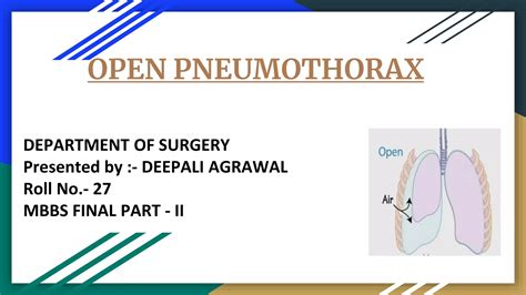 Open pneumothorax | PPT