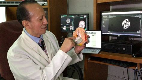 Implanta Issste Chip Cerebral En Pacientes Con Párkinson Instituto De Seguridad Y Servicios