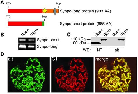 Jci Synaptopodin Regulates The Actin Bundling Activity Of Actinin