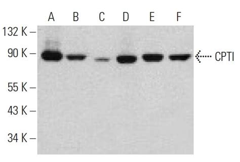 Anti Cpti Antibody E Scbt Santa Cruz Biotechnology