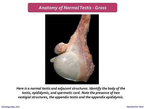 Testis Gross Anatomy