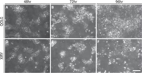 Frontiers Induction Of Neural Crest Stem Cells From Bardet Biedl Syndrome Patient Derived Hipscs