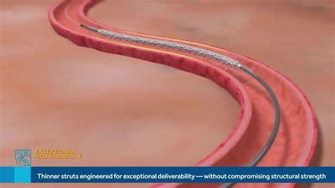 Medtronic Resolute Onyx Drug Eluting Stent At Best Price In Mumbai