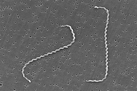 Leptospirosi Descrizione Della Patologia Ed Approfondimenti