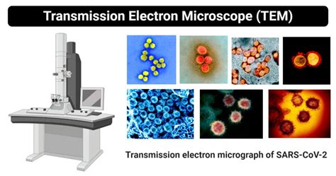 Transmission Electron Microscope (TEM)- Definition, Principle, Images 