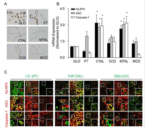 Distribution Of Nlrp Inflammasome Components In Different Nephron