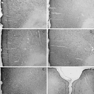 Photomicrographs Showing Fos Expression In The Right ACC A F CPA