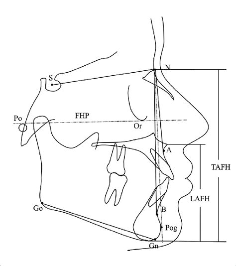 Anb Angle And Downs Facial Angle Angle Formed Between Fhp And Npog Download Scientific