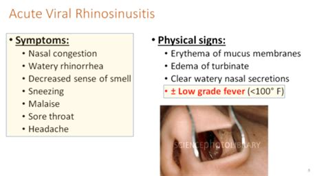 Clinical Medicine 2 Nose Paranasal Sinus Dz Flashcards Quizlet