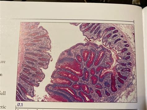 Stains Carbohydrates And Amyloid Flashcards Quizlet