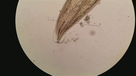 Pinworm Enterobius Vermicularis 100x 400x Magnification Youtube