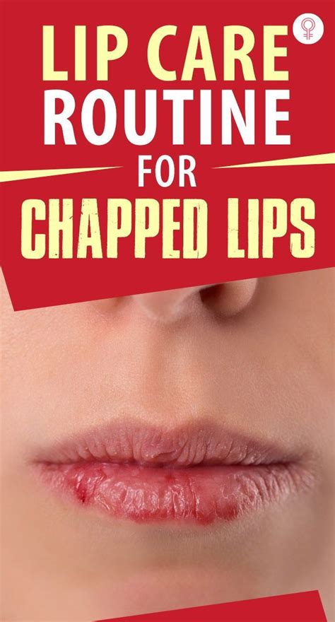 Get Rid Of Chapped Lips Fast Using These 11 Home Remedies Artofit