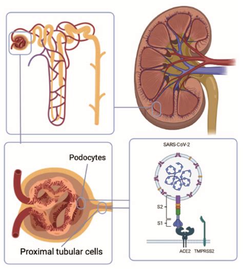 Diseased Kidney