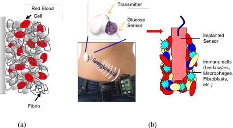 Implantable Amperometric Glucose Lactate Sensors With Nitric Oxide