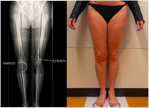 Physio Meets Science On Twitter Visual Inspection For Lower Limb