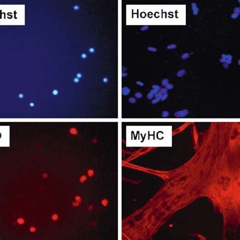 2. Muscle differentiation of isolated satellite cells. Morphological ...