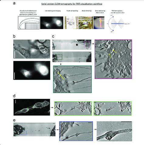 Ultrastructure Of Tunneling Nanotubes TNTs A The Workflow Of Serial