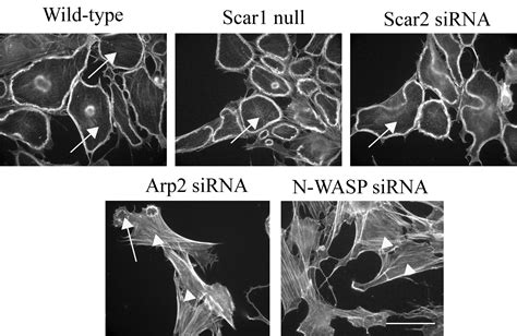 N Wasp Involvement In Dorsal Ruffle Formation In Mouse Embryonic Fibroblasts Abstract