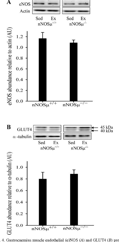 Table 1 From Skeletal Muscle Glucose Uptake During Treadmill Exercise