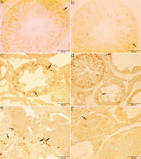 Light Microscopy Of Testicular Tissue In Control And Experimental