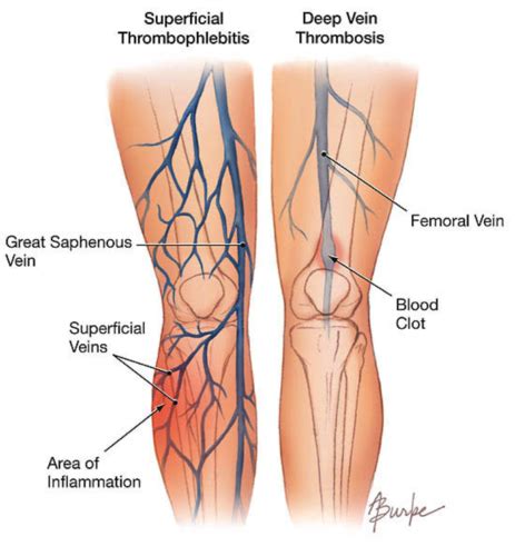 Lecture 1 CLSK Peripheral Vascular System Flashcards Quizlet