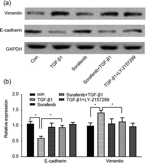 Sorafenib Inhibits Ovarian Cancer Cell Proliferation And Mobility And