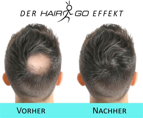 HAIR GO Premium Schütthaar zur Haarverdichtung Haarpuder Streuhaar