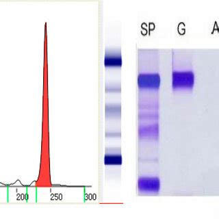 The results of serum protein electrophoresis, immunofixation ...