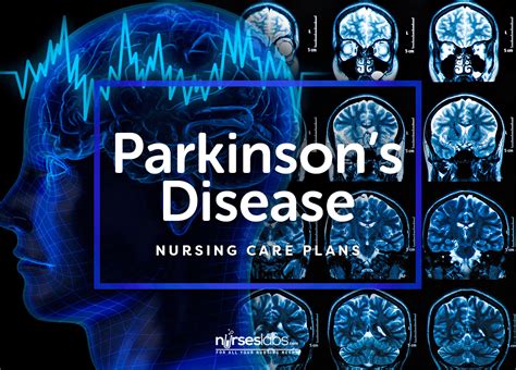 9 Parkinson S Disease Nursing Care Plans Nursing Care Plan