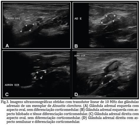 Scielo Brasil Avalia O Ultrassonogr Fica E Mensura Es Das
