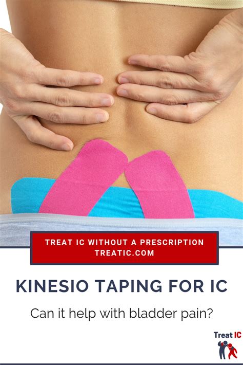 Kinesio Taping Your Bladder Will It Help Ic Treat Ic