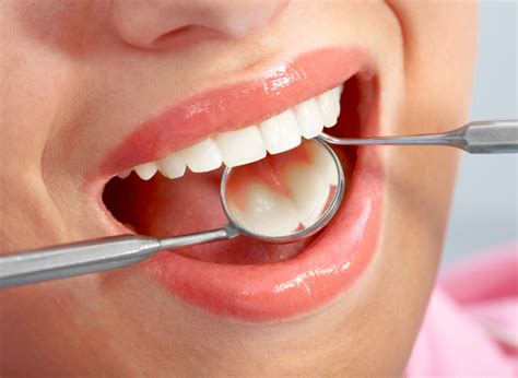 Cómo prevenir la caries Clínica dental del Doctor Calatrava