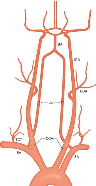 Aortic Arch And Origin Of The Cranial Cerebral Arteries Thoracic Key