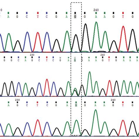 Dna Sequence Chromatogram Showing Nucleotide Sequence Variation In Download Scientific Diagram