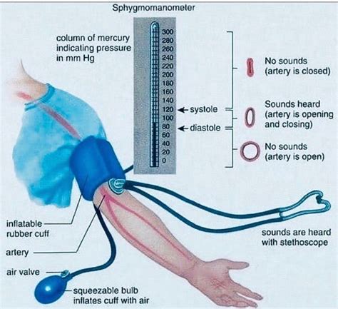 Sphygmomanometer MEDizzy