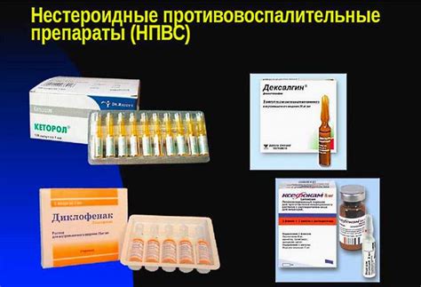 Остеоартроз кистей рук: лечение, симптомы, классификация, диета