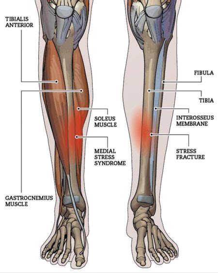 Shin Pain - Vasta Performance Training and Physical Therapy