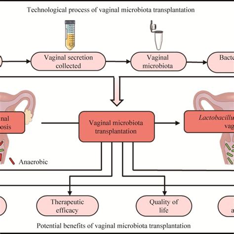 Pdf Vaginal Microbiota Transplantation For Treatment Of Bacterial