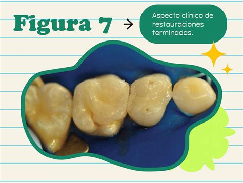 Fluoruro De Plata Diamino Restauraci N Dental Hay Una Justificaci N