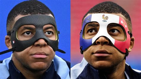 Perché Mbappé non può indossare la maschera tricolore agli Europei è