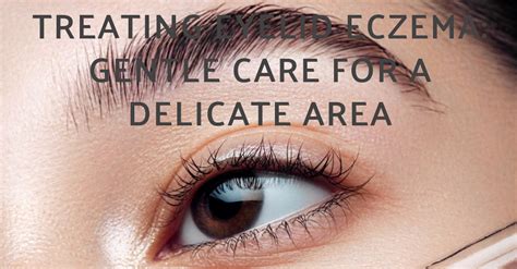 Treating Eyelid Eczema: Gentle Care for a Delicate Area