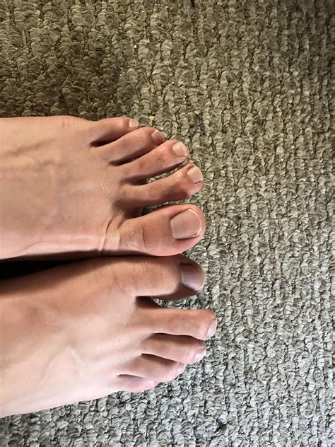 Lost movement of only my right big toe after a long game of kickball