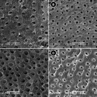 Density and diameter of the dentin tubules by SEM. A. Dentin tubules of ...